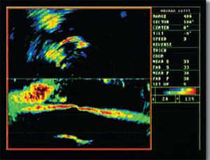 Sonar für Boot
